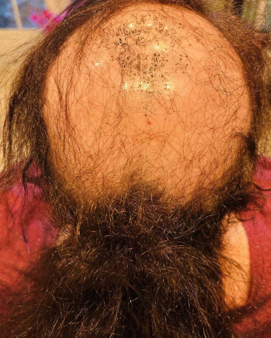 Before: prior to styling