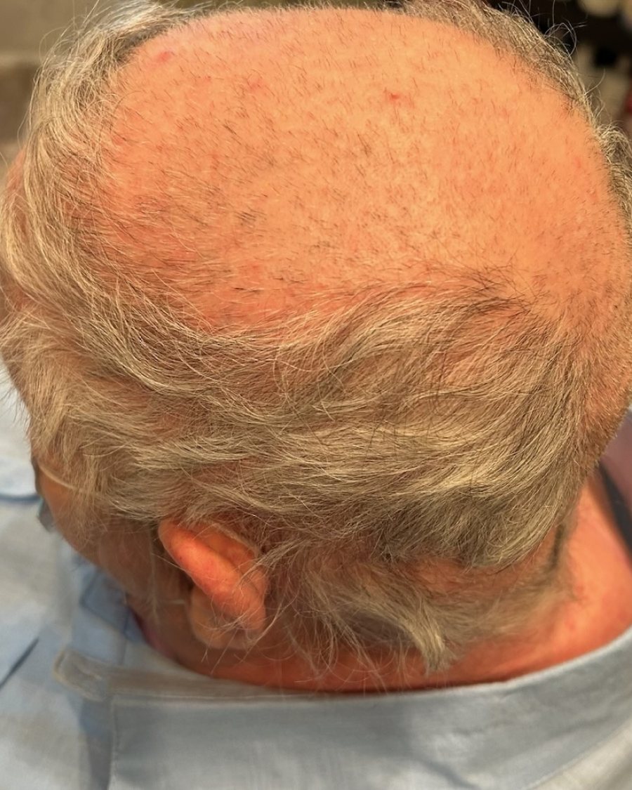 Before: prior to styling